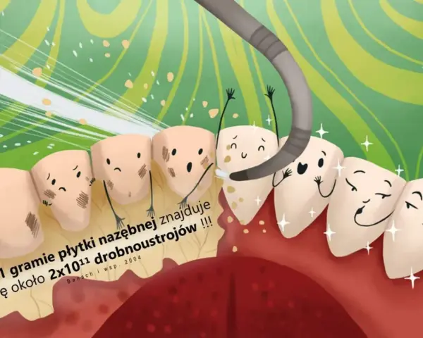 Piaskowanie zębów: Odzyskaj naturalny blask i gładkość. Poradnik