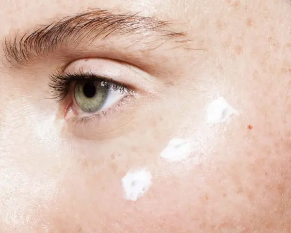 Nahaufnahme eines Auges mit Sommersprossen und drei Tupfern weißer Creme, die auf die Haut aufgetragen werden. Mögliche Ursachen für feuchte Haut.