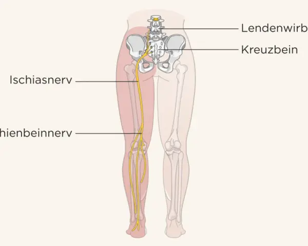 Illustration des Ischiasnervs, der vom Kreuzbein bis ins Bein verläuft. Ein Geheimtipp bei Ischias: Verständnis der Anatomie.