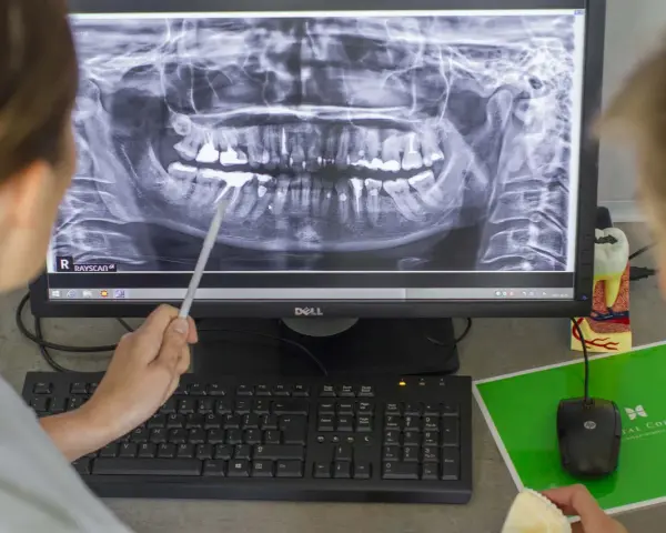 Górna dwójka: Jeden kanał to norma? Sprawdź, co mówi dentysta