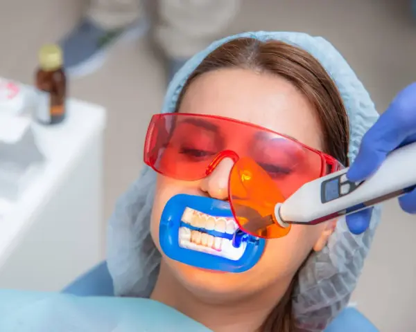 Kobieta przechodzi zabieg wybielania zębów u dentysty. Specjalista używa lampy aktywującej żel wybielający.