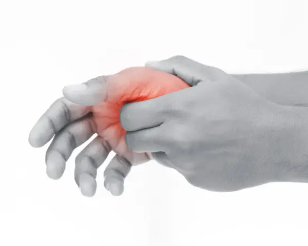 Hand mit roter Markierung am Daumenballen innen, die auf Schmerzen hindeutet.