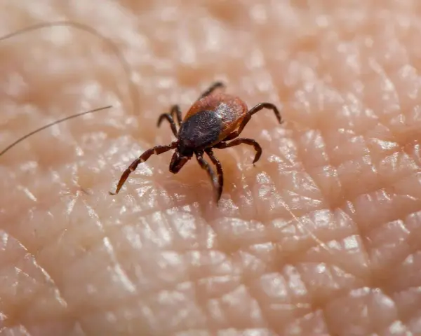 Garrapata en piel humana, un ejemplo de los tipos de garrapatas en España.
