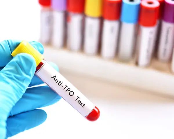 Ręka w niebieskiej rękawiczce trzyma probówkę z krwią do badań immunologicznych u dzieci. Test Anti-TPO.