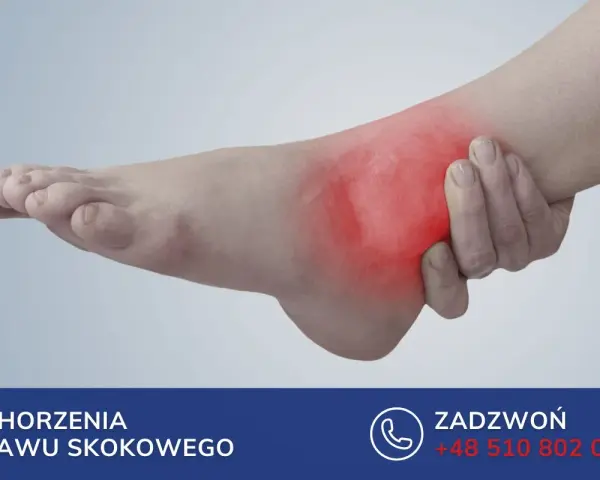 Ból w stawie skokowym, zaczerwienienie i obrzęk wskazują na problem z więzadłem ATFL. Skontaktuj się po pomoc.