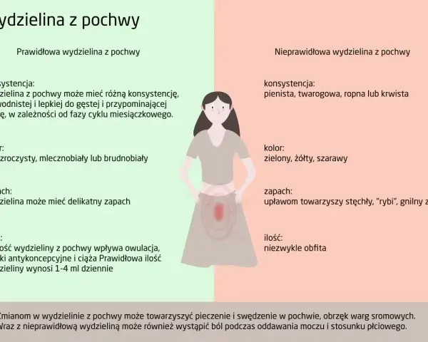 Prawidłowa i nieprawidłowa wydzielina z pochwy. Nieprawidłowa wydzielina może mieć nieprzyjemny zapach, być obfita i towarzyszyć jej mogą upławy.
