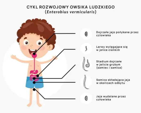 Owsiki w żłobku: Kiedy dziecko wraca? Poradnik dla rodziców