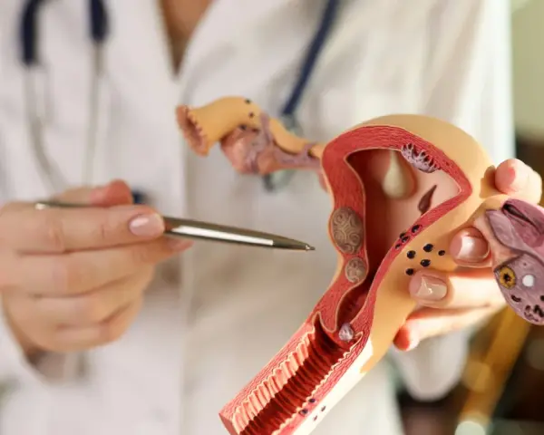 Lekarz wskazuje na model narządów rodnych kobiety, omawiając budowę endometrium.