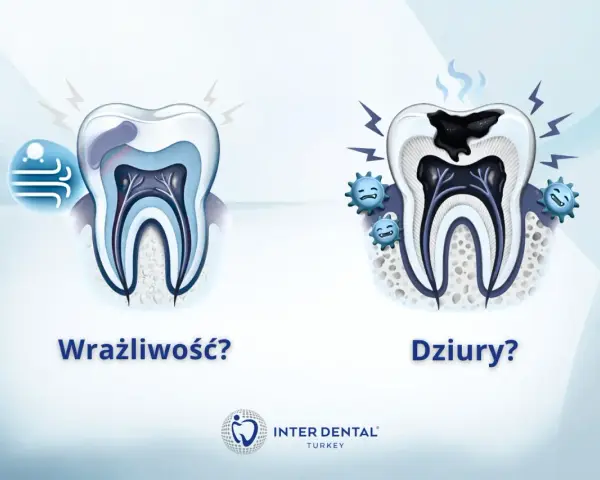 Zdrowy ząb po lewej, zniszczony przez próchnicę po prawej. Czy próchnica śmierdzi? Tak, a te uśmiechnięte bakterie to potwierdzają.