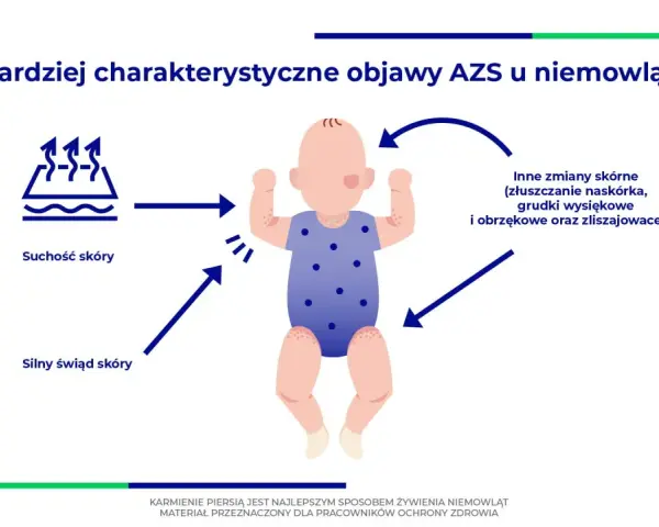 Objawy AZS u niemowląt: suchość i silny świąd skóry, inne zmiany skórne. Karmienie piersią to najlepszy sposób żywienia.