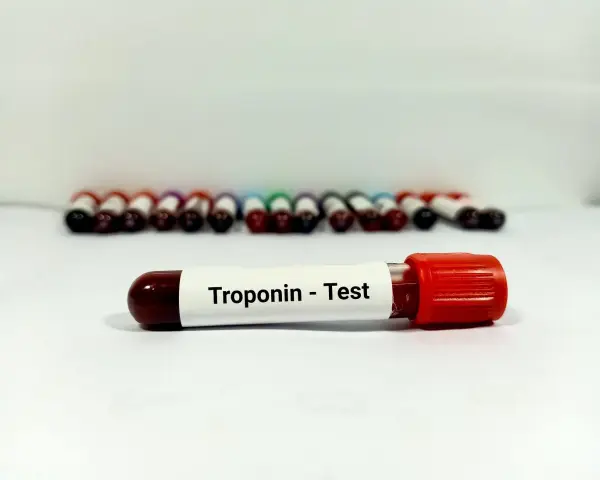 Probówka z oznaczeniem "Troponin - Test" na tle rzędu innych próbek krwi.