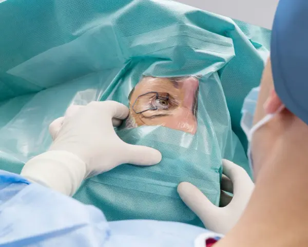 Chirurg w rękawiczkach przygotowuje oko pacjenta do zabiegu laserowej korekcji wzroku.