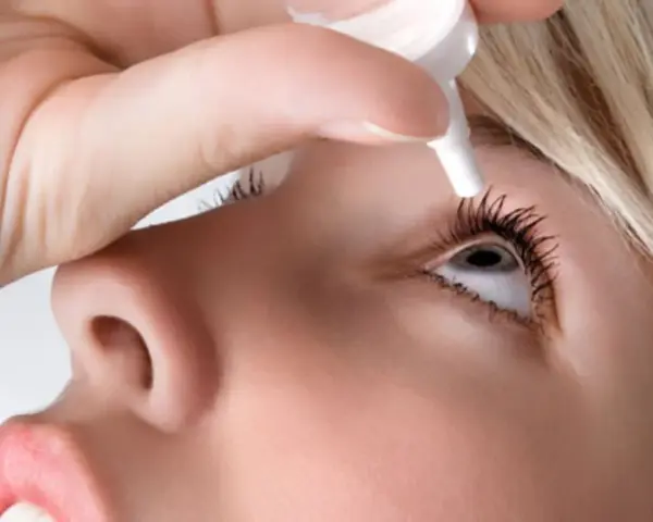 Persona applica collirio per trattare l'edema corneale post cataratta, alleviando i sintomi.