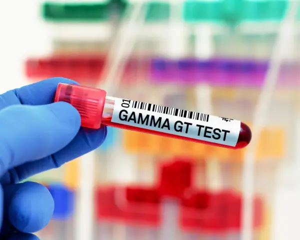Ręka w niebieskiej rękawiczce trzyma probówkę z krwią oznaczoną "GAMMA GT TEST". To badanie ocenia poziom enzymu gamma-glutamylotranspeptydazy.
