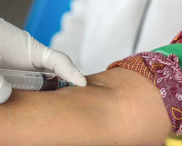 Pobieranie krwi do badań, by sprawdzić, czy cholesterol HDL norma jest prawidłowa.
