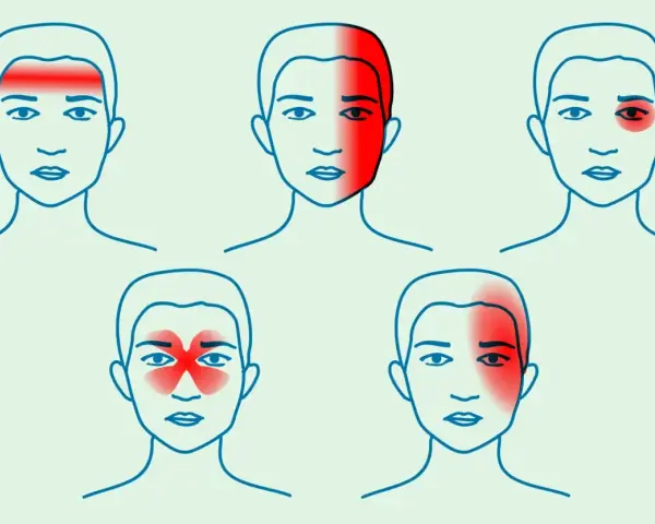Jak zwalczyć ból głowy? Ulga, przyczyny i skuteczna profilaktyka