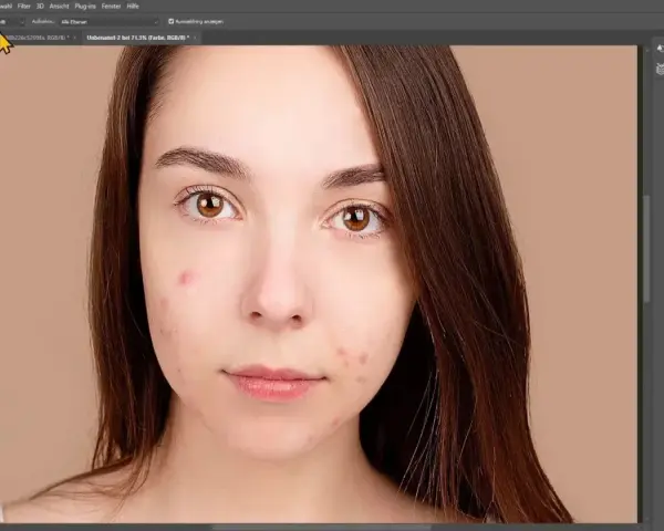 Portrait d'une jeune femme avec des imperfections cutanées, en cours de retouche dans Photoshop.