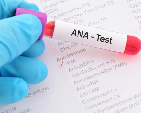 Ręka w niebieskiej rękawiczce trzyma probówkę z krwią do testu ANA. Na formularzu zaznaczono ANA.