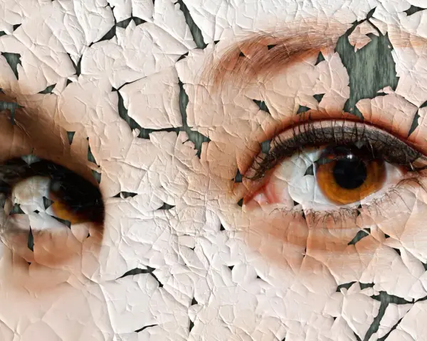 Nahaufnahme von Augen mit rissiger, schuppiger Haut.