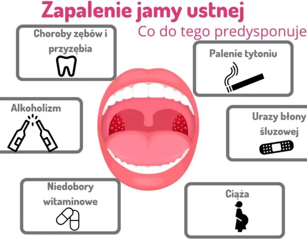 Skuteczne płukanki na stan zapalny jamy ustnej, które przynoszą ulgę