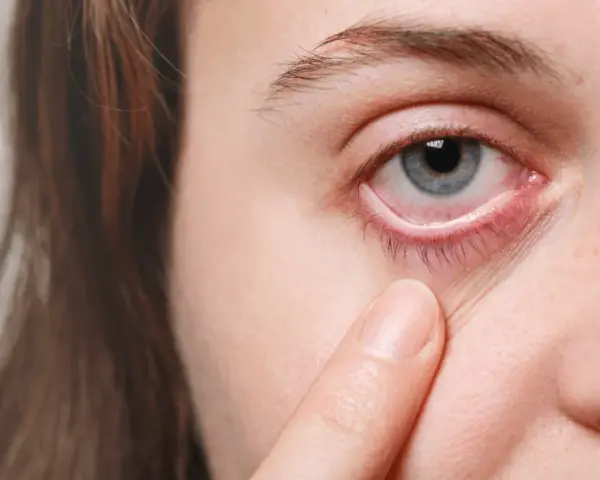 Sjögren Syndrom Diagnostik: Symptome, Tests und häufige Herausforderungen