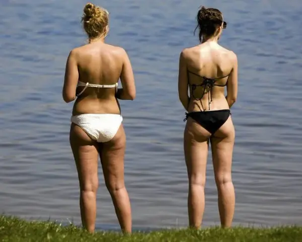 Jak ukryć cellulit na plaży? Skuteczne sposoby na pewność siebie