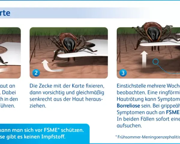 Anleitung zur Zeckenentfernung mit einer Karte: flach unter die Zecke schieben, fixieren und senkrecht herausziehen. Beobachten Sie die Stelle.