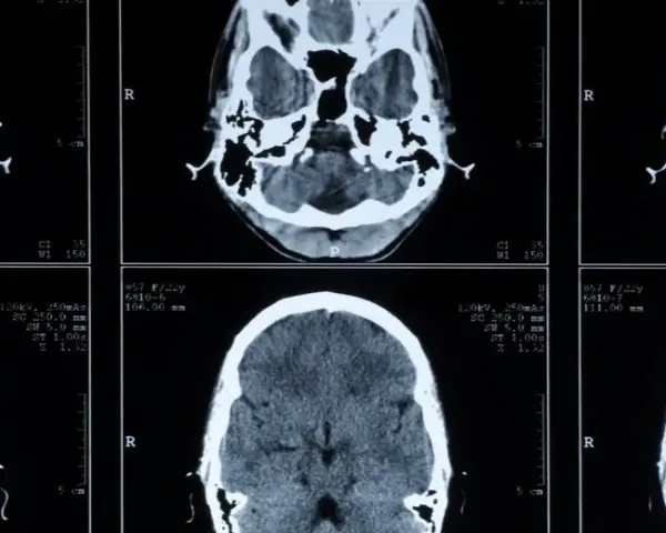 Die Bedeutung der medizinischen Diagnostik für präzise Krankheitsdiagnosen