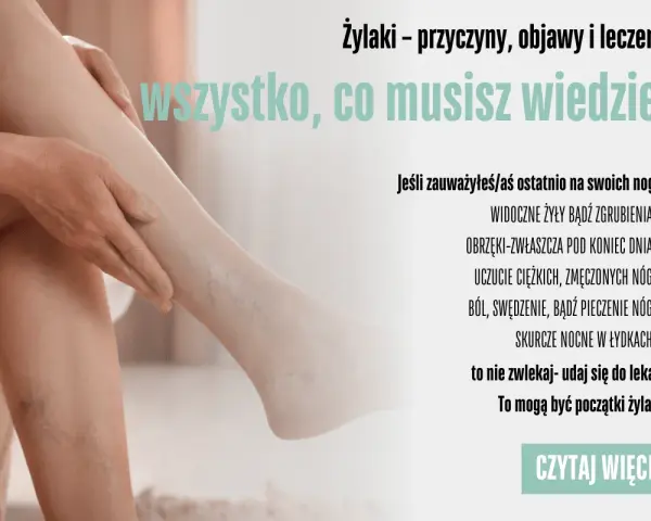 Żylaki? Jak zapobiec i cieszyć się lekkimi nogami każdego dnia