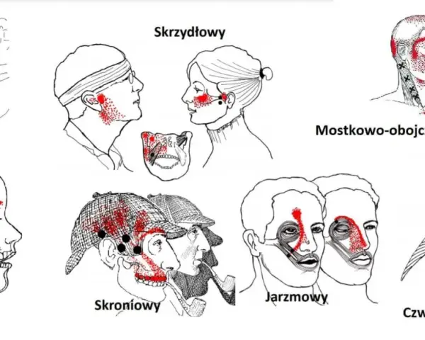 Punkty spustowe w obrębie stawów skroniowo żuchwowych: policzkowy, skrzydłowy, żwacz, skroniowy, jarzmowy, mostkowo-obojczykowo-sutkowy, czworoboczny.