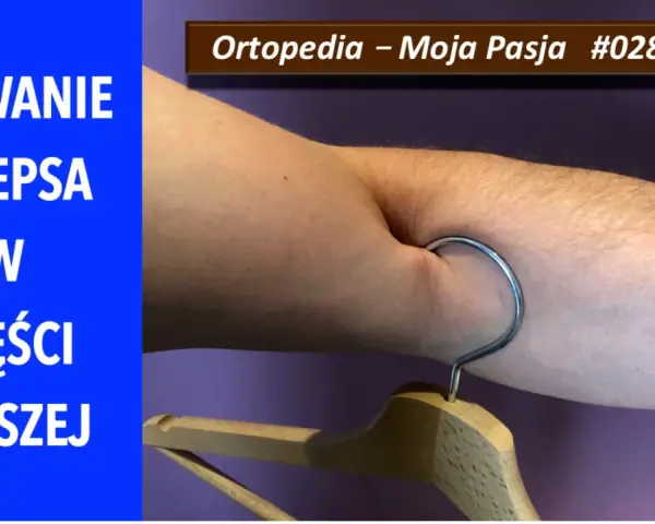 Zerwanie bicepsa w części dalszej. Widoczny hak wbit w mięsień, symbolizujący uraz.