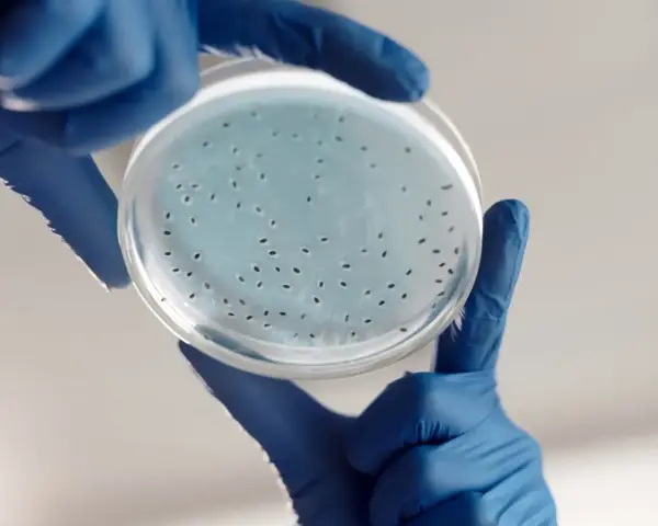 Badanie laboratoryjne wykazuje obecność drobnoustrojów, które mogą być przyczyną infekcji intymnej po antybiotyku.