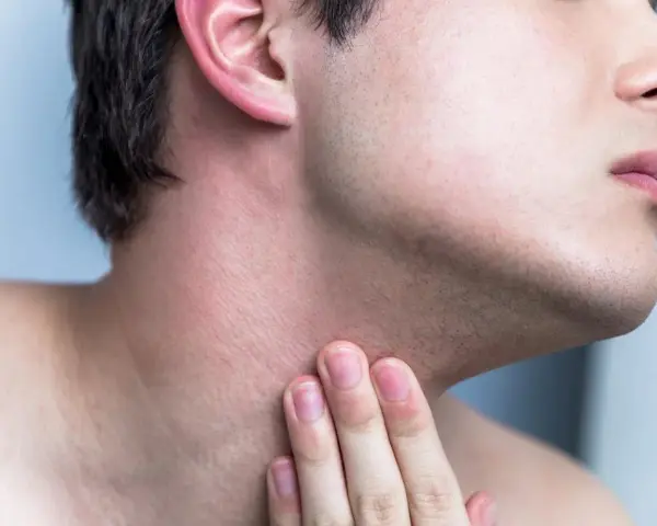 Hombre tocando su cuello con irritación y pequeños granos después de afeitarse.