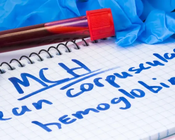 Probówka z krwią, notatnik z napisem "MCH mean corpuscular hemoglobin" i rękawiczki medyczne.