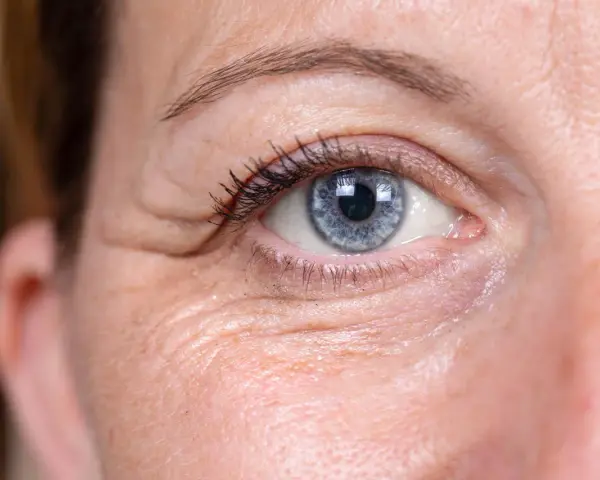 Nahaufnahme eines blauen Auges mit sichtbaren Lachfalten, die typisch für Frauen um die 40 sind.