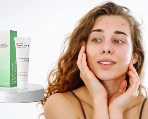 Giovane donna con acne pelle, accarezza il viso vicino a una crema anti-imperfezione Terme di Sirmione.