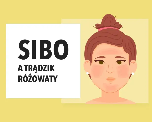 SIBO może objawiać się jako trądzik różowaty. Ilustracja przedstawia twarz z zaczerwienieniami na policzkach i nosie, sugerując problemy skórne.