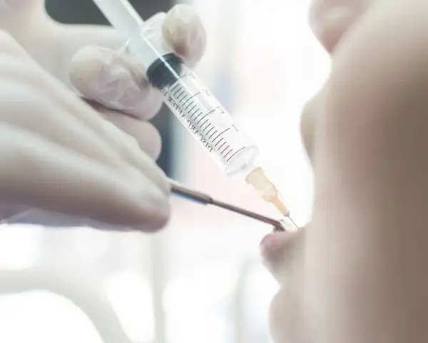 Dentysta podaje znieczulenie pacjentowi strzykawką.