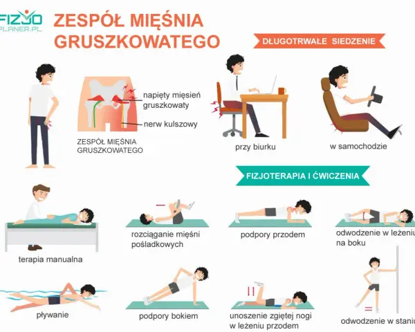 Ilustracja pokazuje zespół mięśnia gruszkowatego, jego przyczyny (długotrwałe siedzenie) i metody leczenia (fizjoterapia, ćwiczenia).