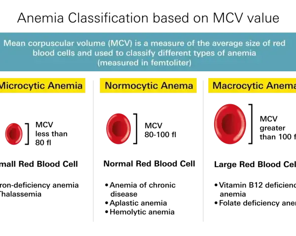 Anemia co to? Porównanie wielkości czerwonych krwinek: mikrocytarna (małe), normocytarna (normalne), makrocytarna (duże).