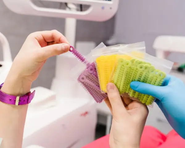 Kolorowe ligatury ortodontyczne w opakowaniach, gotowe do założenia aparatu.