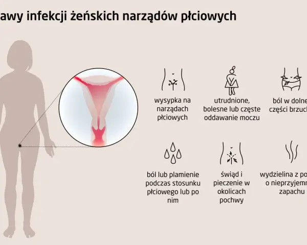 Ilustracja przedstawia sylwetkę kobiety z powiększeniem narządów płciowych i ikonami objawów infekcji.