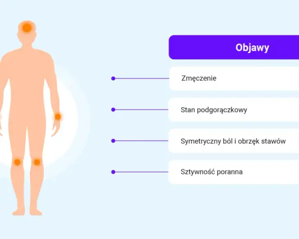 Ilustracja przedstawia objawy reumatoidalnego zapalenia stawów: zmęczenie, stan podgorączkowy, symetryczny ból i obrzęk stawów oraz sztywność poranną.