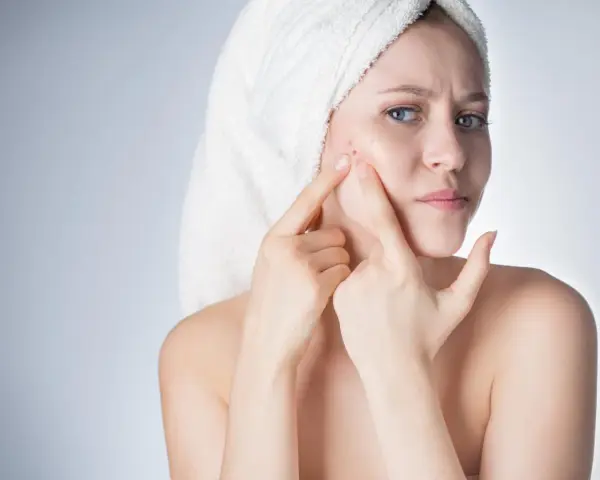 Ragazza con asciugamano in testa che si tocca il viso, preoccupata per un brufolo. La sua pelle mostra segni di imperfezioni.