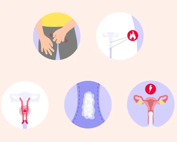 Illustrationen zeigen Juckreiz im Intimbereich, Entzündungssymptome, Ausfluss und Schmerzen. So sieht scheidenpilz aus.
