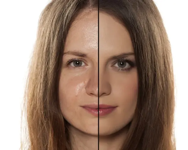 Viso diviso: a sinistra pelle con sebo e imperfezioni, a destra pelle uniformata dal trucco.