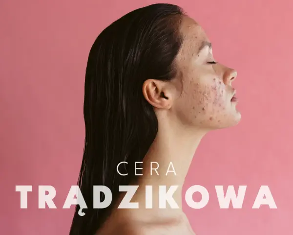 Profil kobiety z cerą trądzikową. Dowiedz się, jak dbać o cerę trądzikową i odzyskać jej zdrowy wygląd.