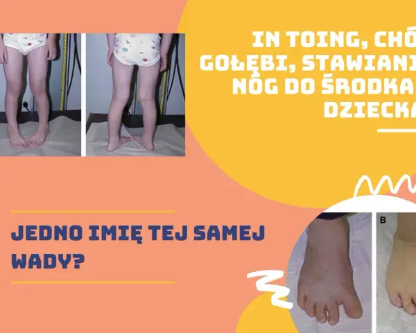 Dziecko z zaburzeniami chodu: "chod gołębi", "stawianie nóg do środka". Czy to ta sama wada?
