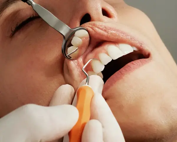 Znieczulenie u dentysty w ciąży: Bezpieczne leczenie dla mamy i dziecka