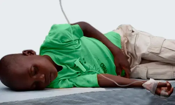 Cholera Symptome: Warnzeichen erkennen und ernsthafte Folgen vermeiden